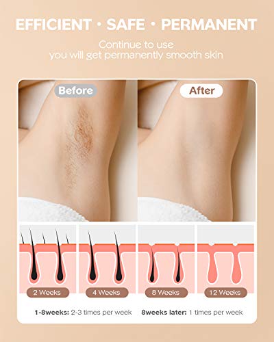 IPL Hair Removal Device for Women (999,000 Flashes)