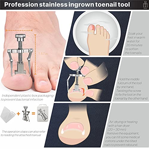 Ingrown Toenail Tool Kit