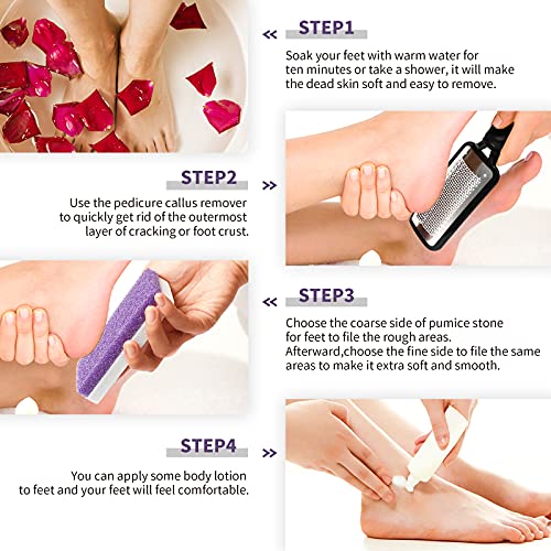 SWEHOME Professional Feet Rasp Scrubber Foot File and 2 in 1 Pumice Stone