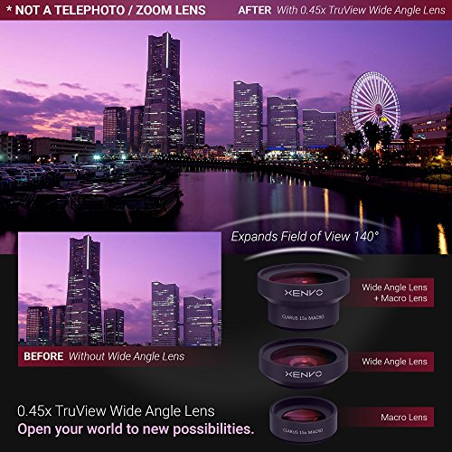 Xenvo Pro Lens Kit with LED Light and Travel Case
